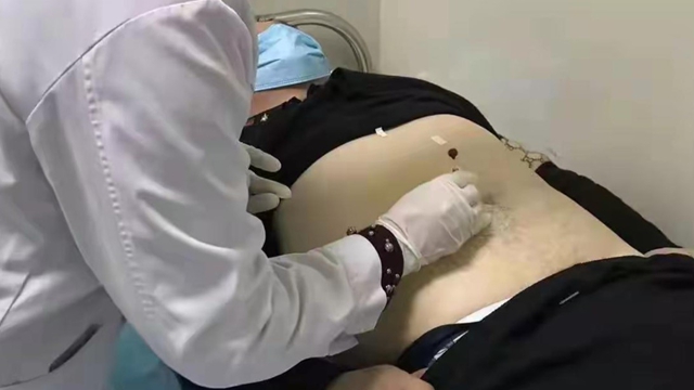 駐馬店市中醫院推廣穴位埋線減肥：新興療法受青睞 輕松享"瘦"