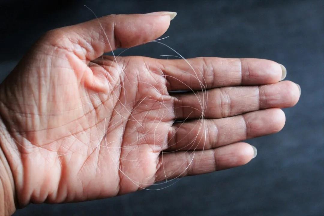 白頭發(fā)拔一根長三根？到底能不能拔？終于弄清楚了