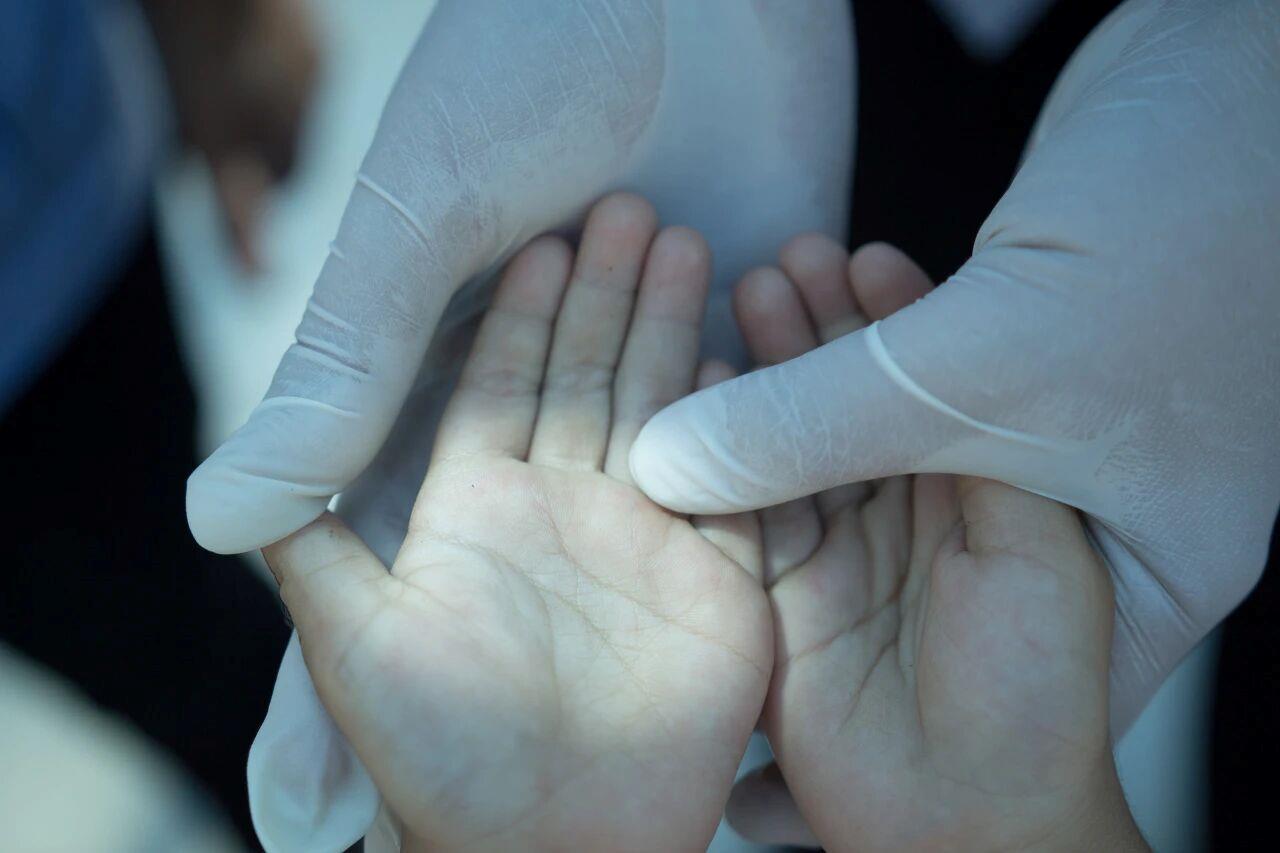 關(guān)于手足口病的8個常見誤區(qū),一次說清!