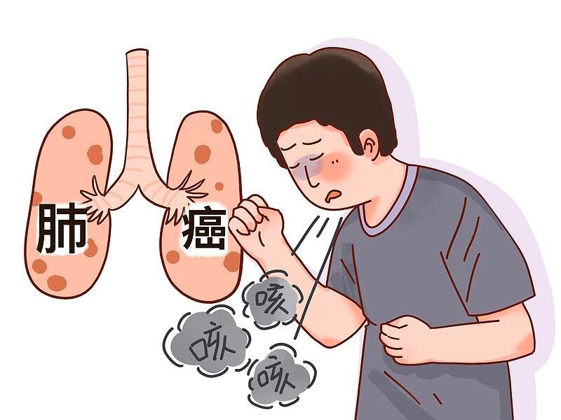 肺癌一發現就是晚期？身體給出的暗示，不要忽視