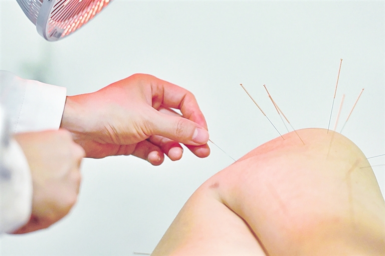 針灸調理 重在得氣